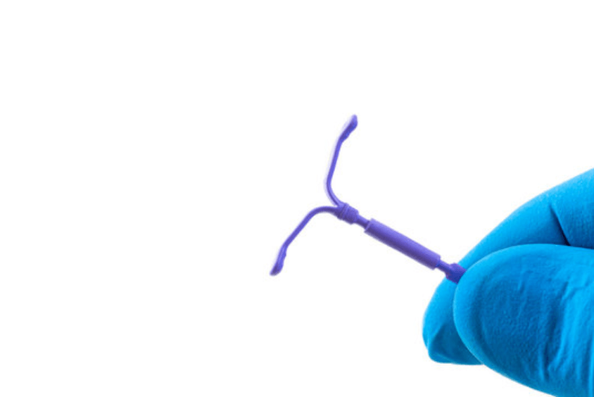 O DIU é um dispositivo colocado no interior do útero que funciona como contraceptivo. Suas formas mais comuns são DIU hormonal e o DIU de cobre.