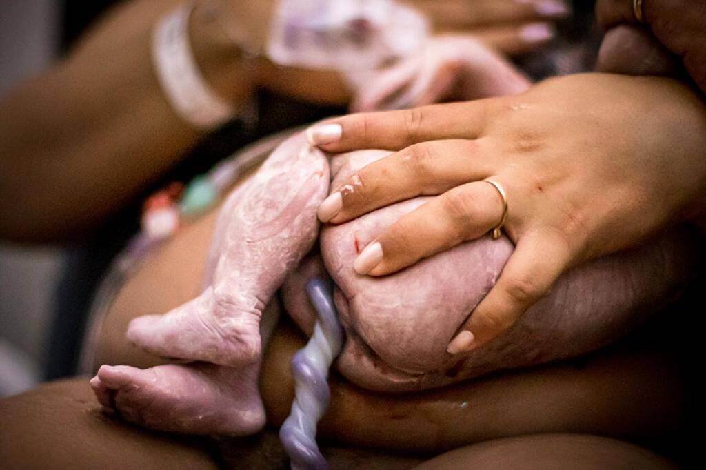 sangue cordão umbilical