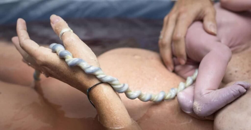 sangue cordão umbilical