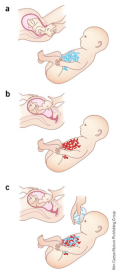 microbiota intestinal
