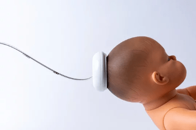 Você sabe utilizar o vácuo-extrator no parto normal?