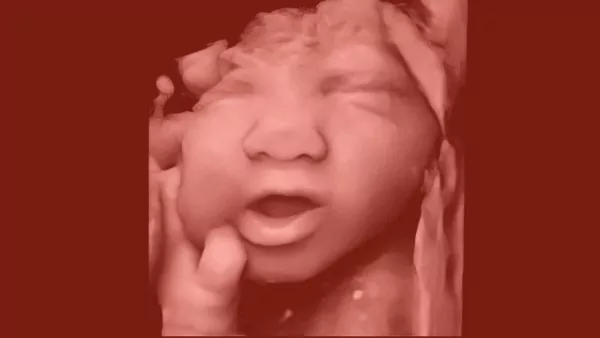 lp-google-ultrassom-4d-instituto-villamil